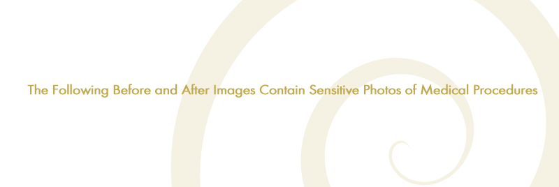 sensitive images disclaimer