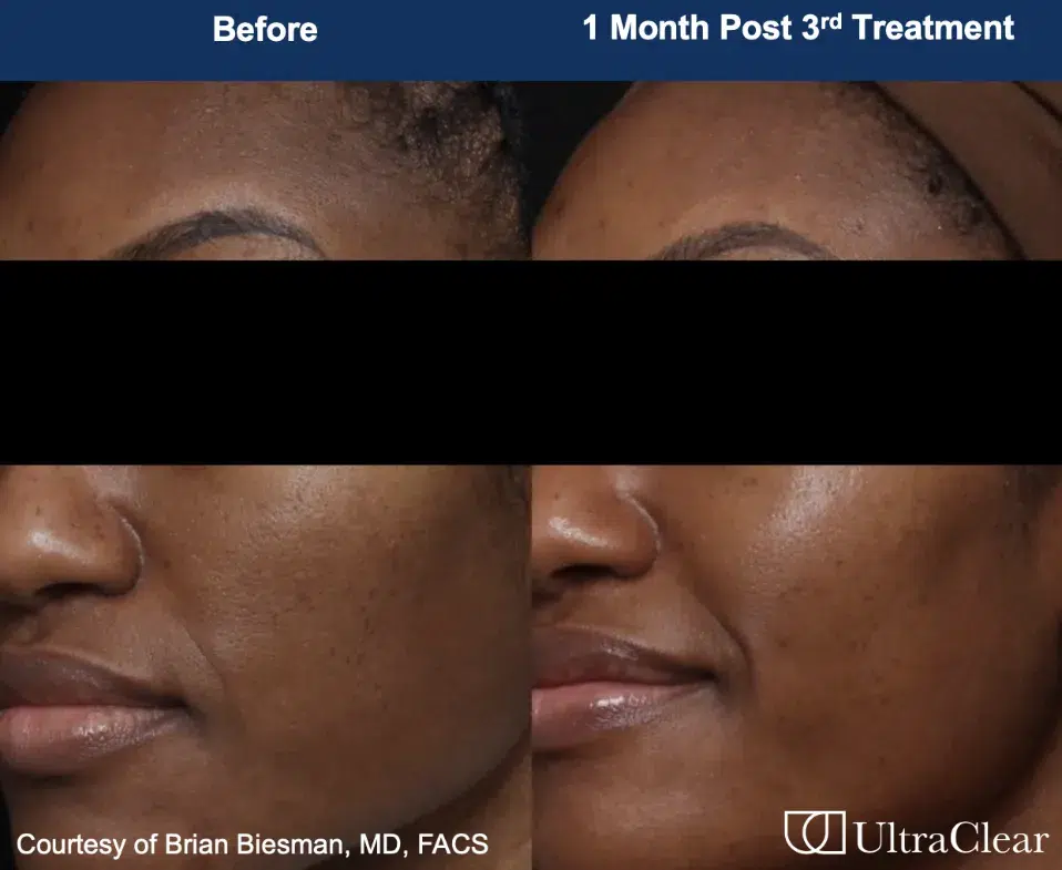 B&A 2